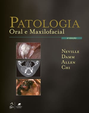 Patologia Oral e Maxilofacial