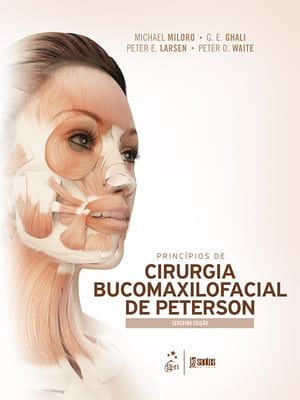Princípios de Cirurgia Bucomaxilofacial de Peterson, 3ª edição