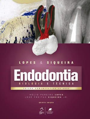 Endodontia – Biologia e Técnica